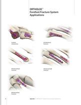 ORTHOLOC® Forefoot Fracture System ? FA255?409 - 8