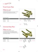 Foot Plating System-8