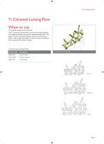 Foot Plating System-9