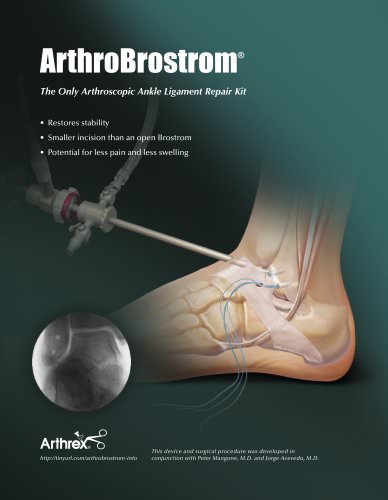 Arthrex - Low Profile Ligament Staples