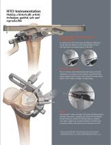 HTO Medial PEEK Implant - 3