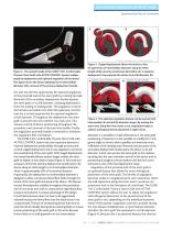 Endovascular - 5
