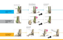 Ankle Plating System 3 Brochure (LEX40-05-F)-12
