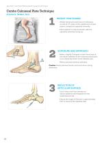 Calcaneal Plating System Surgical Technique (LEX00-05-E)-10