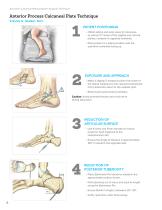 Calcaneal Plating System Surgical Technique (LEX00-05-E)-6