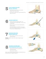Calcaneal Plating System Surgical Technique (LEX00-05-E)-7