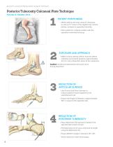 Calcaneal Plating System Surgical Technique (LEX00-05-E)-8