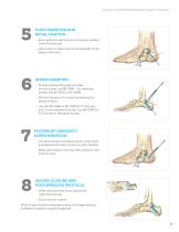 Calcaneal Plating System Surgical Technique (LEX00-05-E)-9