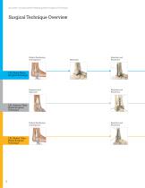 Locking Ankle Plating System Surgical Technique (LEX00-04-C)-10