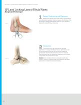 Locking Ankle Plating System Surgical Technique (LEX00-04-C)-12