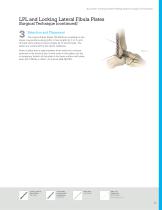 Locking Ankle Plating System Surgical Technique (LEX00-04-C)-13