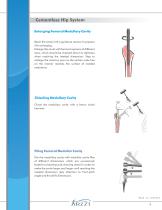 Cementless Hip System-10
