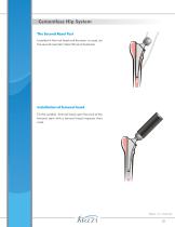 Cementless Hip System-13