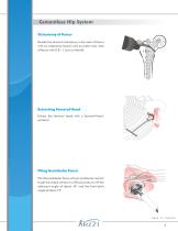 Cementless Hip System-7