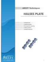 Dohler System: Halses-2