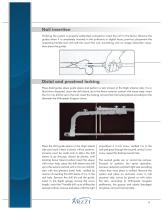 Ins Hilden Femoral-10