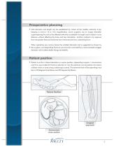 Ins Hilden Femoral-4