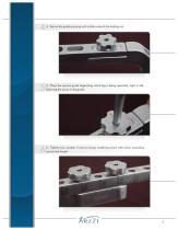 Ins Hilden Femoral-7