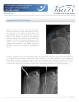 Intramedullary locked Nailing With Screws for Humerus Fractures-10