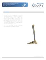 Intramedullary Locked Nailing With Screws for Tibia Fractures-4