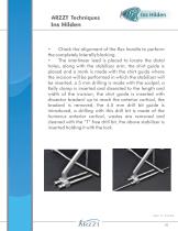 Intramedullary Nail for Humerus-11