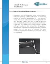 Intramedullary Nail for Humerus-12