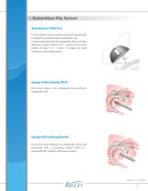 ZHS1 Cementless Hip System-8