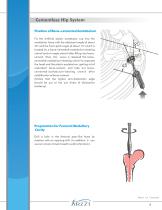 ZHS1 Cementless Hip System-9