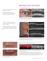 OCT Image-Guided Laser Treatments - 5