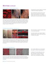 OCT Image-Guided Laser Treatments - 6