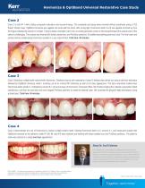 Harmonize™ & OptiBond™ Universal Restorative Case Study-2
