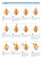 基本症例におけるimplants臨床編 基本症例におけるimplants臨床編 基本症例における IMPLANTS