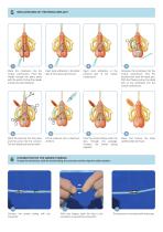 基本症例におけるimplants臨床編 シエン社 | 基本症例における IMPLANTS [臨床編]
