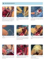 基本症例におけるimplants臨床編 シエン社 | 基本症例における IMPLANTS [臨床編]