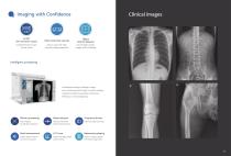 Digital mobile radiography unit  MobileApex-6