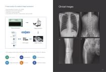 Digital mobile radiography unit MobileCooper-6