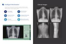 Digital mobile radiography unit  MobileGenius-6