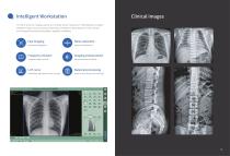 Digital mobile radiography unit  MobileSparkler-6