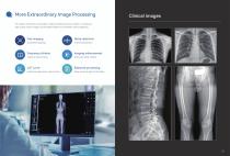 Dynamic digital radiography PerfoX 5500 (Dynamic)-6