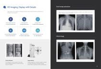 fluoroscopy systems  PerfoX 7500 (Dynamic)-4