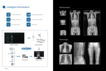 radiography system  with table PerfoX 3000 Classic-4
