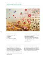 Inion BioRestore™-4