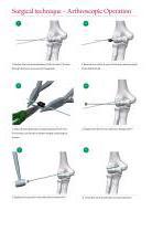 Inion FreedomPin™-3