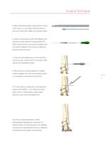Inion FreedomScrew™ - Bioabsorbable Screw-5