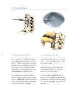 Inion S-1™ System-3