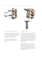 Inion S-1™ System-4