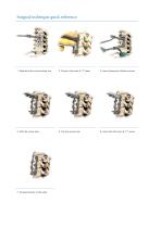 Inion S-1™ System-9