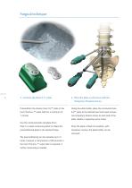 Inion S-2™ Surgical-10
