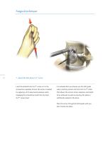 Inion S-2™ Surgical-12