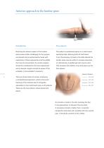 Inion S-2™ Surgical-4